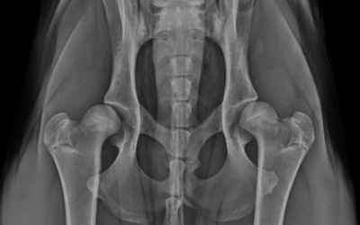 Hip Dysplasia