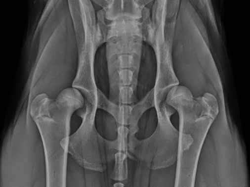 Hip Dysplasia