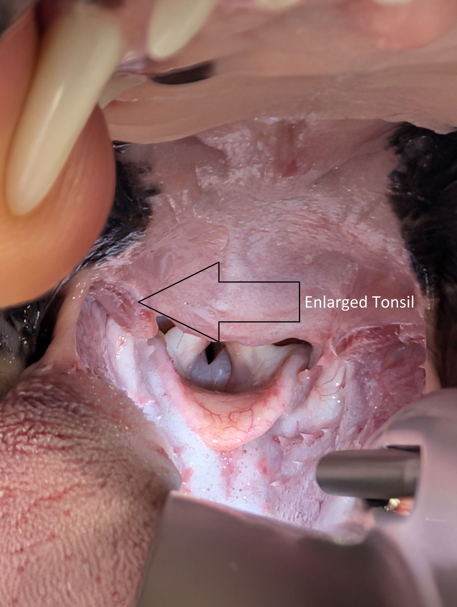 Bunbury & Eaton Vet Clinics - Enlarged Tonsils Bunbury & Eaton Vet Clinics - Enlarged Tonsils